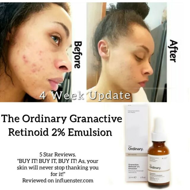 امولسیون ضد چروک گرن اکتیو رتینوئید اوردینری (اصل) 2%The Ordinary Granactive Retinoid 2% Emulsion حجم ۳۰ میل
