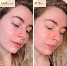 تونر لایه بردار AHA و روشن کننده پوست رن (اصل) مدل Ren Clean Skincare Ready Steady Glow Daily AHA Tonic 100ml حجم 100 میل