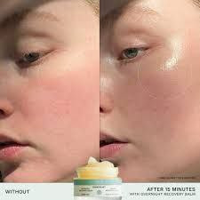 کرم شب ترمیم کننده اور کالم رن ( اصل ) evercalm Restorative night cream Ren clean skincare