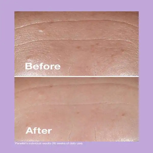 کرم شب اسمارت نایت ضدچروک و جوانساز و ترمیم کننده کلینیک (اصل) حجم ۱۵ میل مدل Clinique Smart Night Custom-Repair Moisturizer 15ml