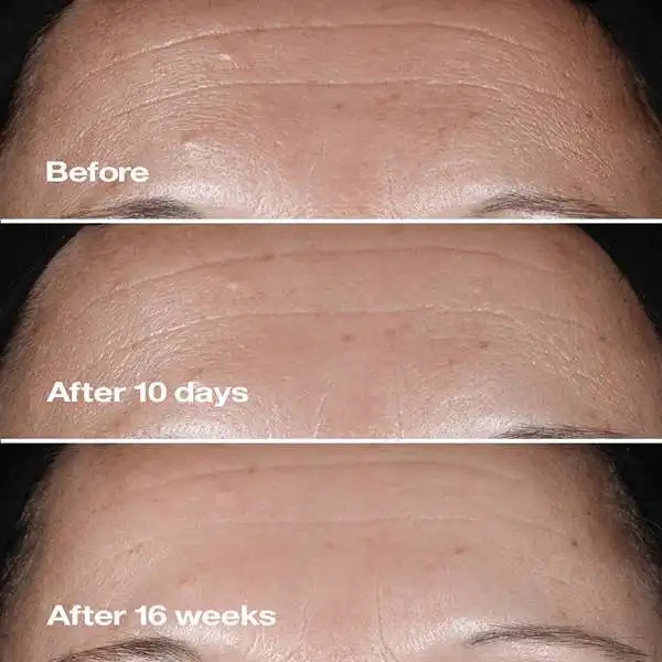 کرم شب اسمارت نایت ضدچروک و جوانساز و ترمیم کننده کلینیک (اصل) حجم ۱۵ میل مدل Clinique Smart Night Custom-Repair Moisturizer 15ml